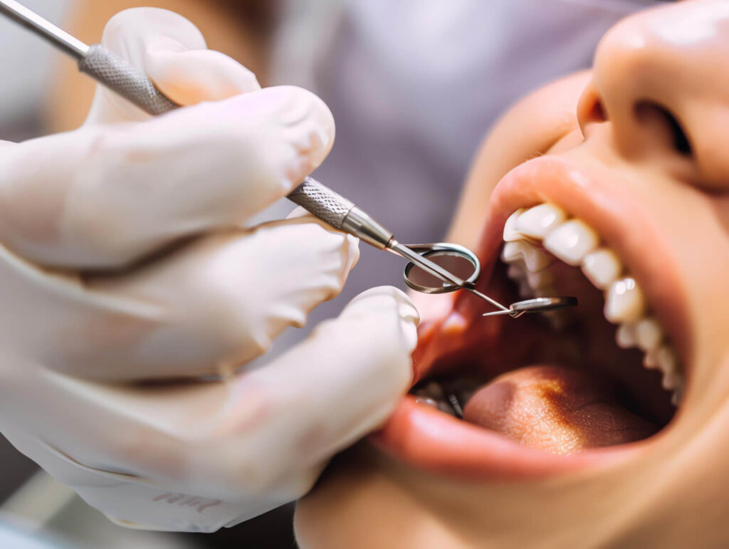 שיקום פה מורכב