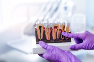 שיקום פה מלא